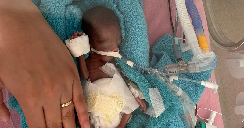 350 gram doğmuştu! Rüzgar bebek 240 gün sonra yaşam mücadelesini kazandı Haberler