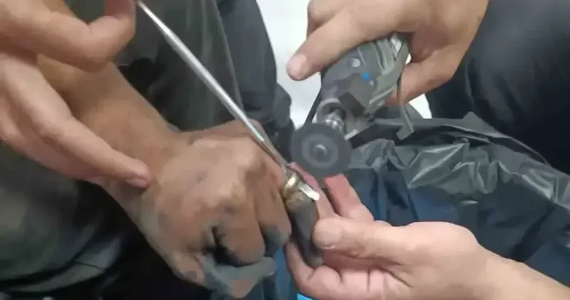 Parmakta sıkışan yüzük hastanede doktor ve itfaiye ekibi tarafından çıkartıldı Aktüel Haberleri