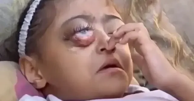 Gazze’de 4 yaşındaki Rital hayat mücadelesi veriyor VİDEO İZLE