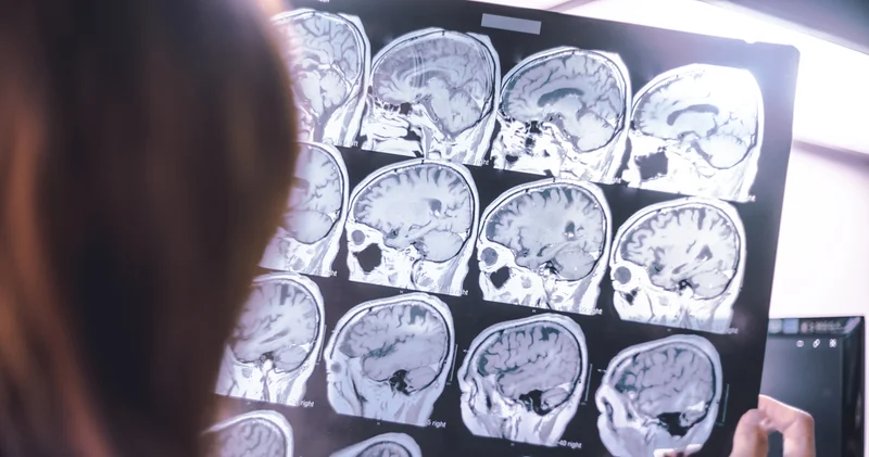Teşhis krizi! Birleşik Krallık ta 20 bin kişi farkında olmadan Parkinson’la yaşıyor Sağlık Haberleri