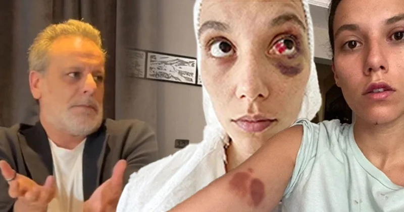 Kadına şiddetten hapis yatacak Ozan Güven den skandal savunma! Abajurla Deniz Bulutsuz u darbetmişti