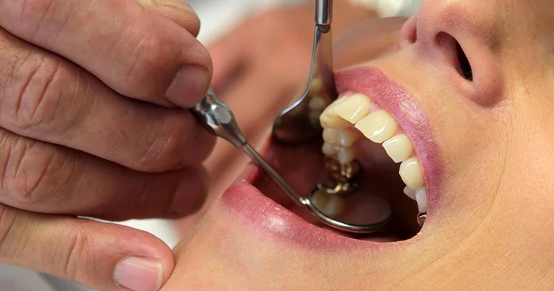 İlerleyen diş çürüğü sistemik hastalıkları tetikleyebilir