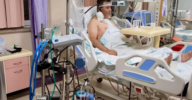 Kalp ameliyatında ECMO başarısı, bir ilk oldu Sivas Haberleri