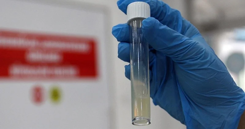 DSÖ: Tüberküloz nedeniyle her yıl bir milyon kişi hayatını kaybediyor Sağlık Haberleri