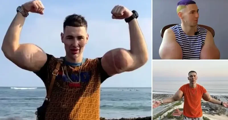 Rus Temel Reis kollarını kaybetmek üzere Aktüel Haberleri