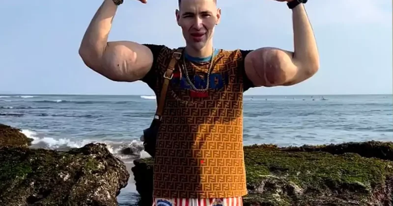 Rus Temel Reis in kolları tehlikede: Tehlikeli enjeksiyonlar ağır enfeksiyona yol açtı