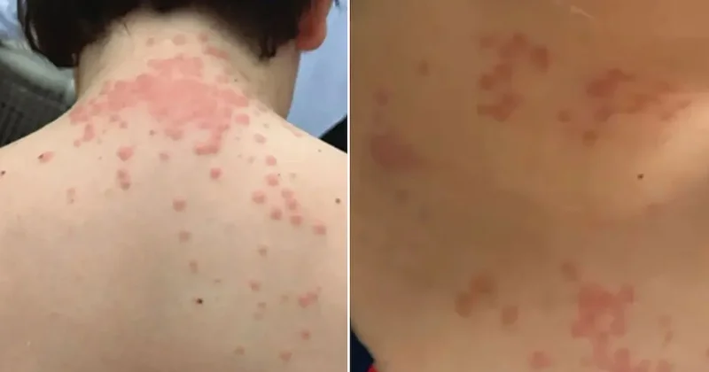 Dev hava yolunun uçaklarını böcekler bastı: Yolcular perişan hale geldi Sözcü Gazetesi