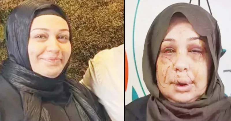 Evli olduğu kadına şiddet uygulayan Cumhurbaşkanı Koruma Dairesi personeli Çakmak ın ifadesi: Arbedede tırnak makasıyla yaralandı