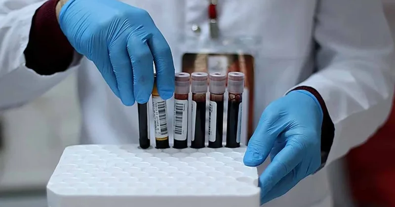 50 bin kişi incelendi: Bu 3 kan grubunda kanser riski %55 daha fazla Sözcü Gazetesi