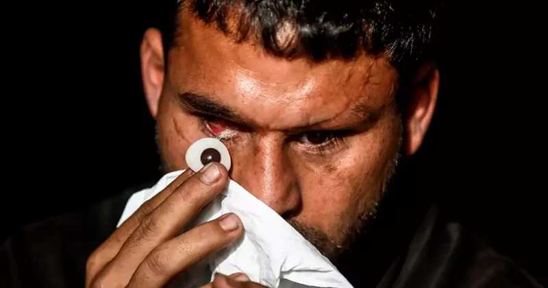 Savaşta iki kez yaralandı, gözlerini kaybetti