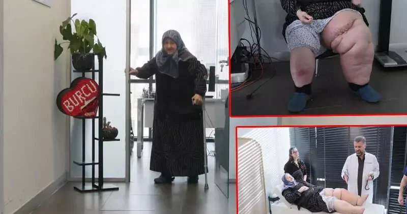 Fil hastalığıyla mücadele ediyordu; tedaviyle 2 haftada ayağa kalktı