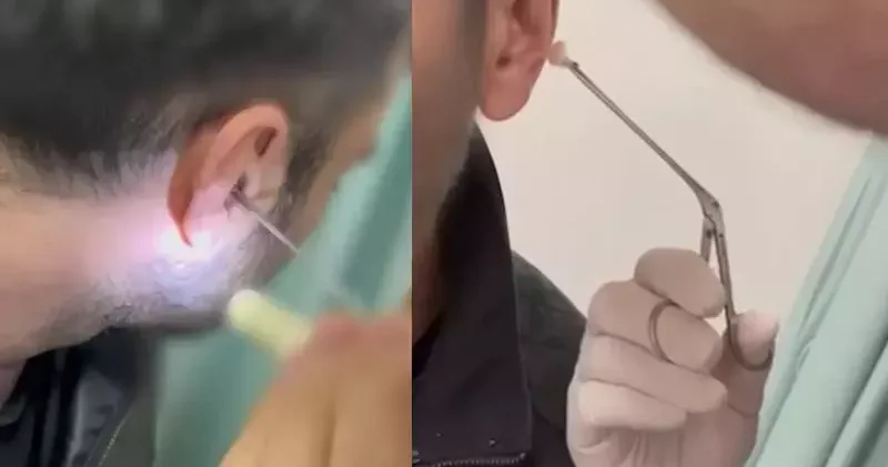 Kulağına gizlediği uyuşturucuyla yakalandı