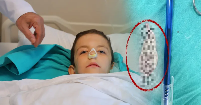 Burun tıkanıklığı, kulak ağrısıyla gitti: Ağzından dev polip çıkartıldı