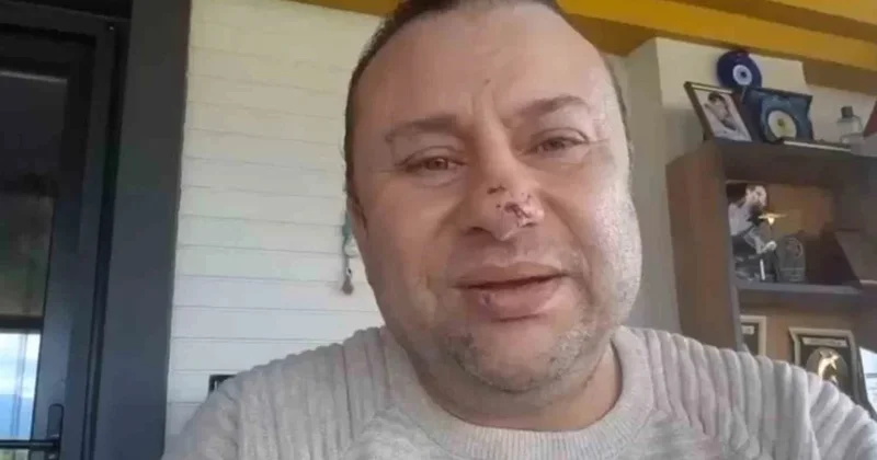 Pitbull saldırısında et yiyen bakteri bulaştı: İşte Onur Akay ın son durumu Sözcü Gazetesi