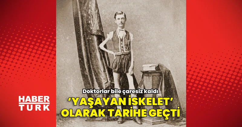 Hastalığı çözülemedi, kilo kaybetmeye devam etti: 19. yüzyılın “Yaşayan İskelet”i olarak tarihe geçti