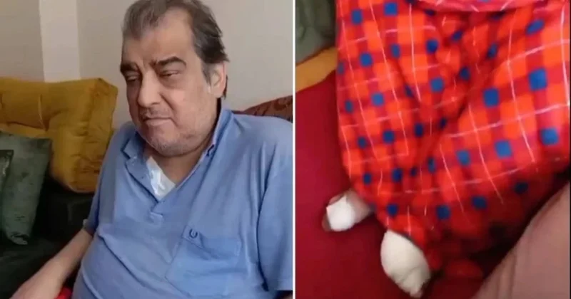 Ayak parmakları kesilmişti... Ömer Danış tan haber var Sözcü Gazetesi