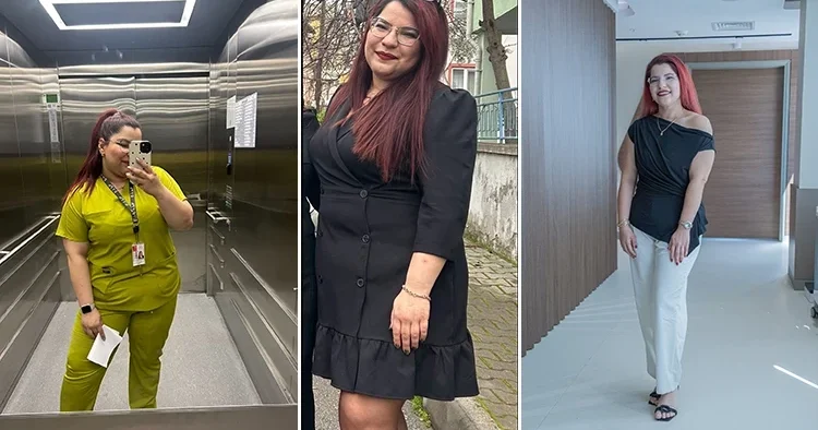 Ankara da tüp mide ameliyatı olan hemşire Burcu, 9 ayda 42 kilo verdi