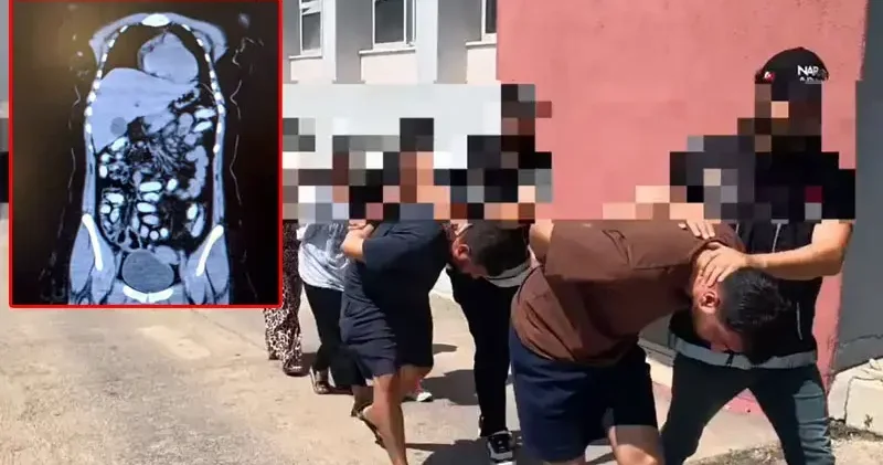 Midesinde 1,5 kilo metamfetaminle yakalanan 2 kadın kurye tutuklandı