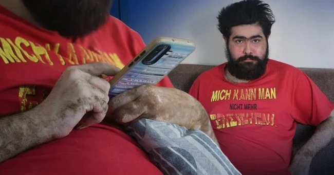 Hayat hikayesi ile Türkiye nin dikkatini çeken Barış ın son hali şaşırttı: En son ne zaman duş aldığımı hatırlamıyorum