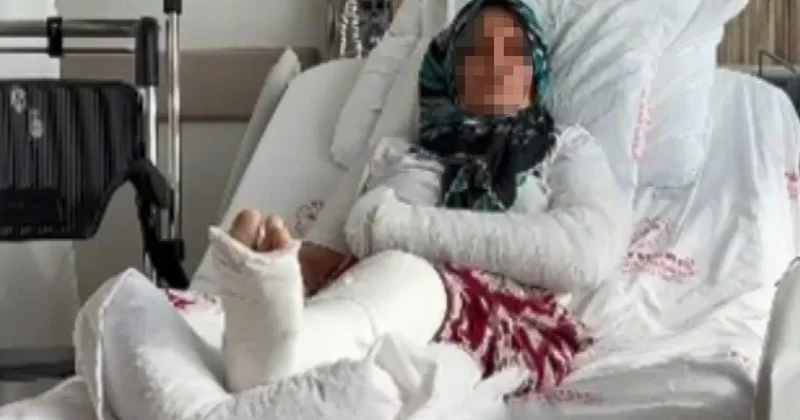 Mersin de tatlıcı saldırısında iddiaya göre kadının kolu ve bacağı kırıldı