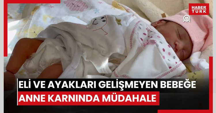 Eli ve ayakları gelişmeyen bebeğe anne karnında müdahale