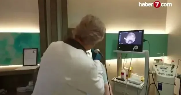 Dilinin yarısı alındı, mikrocerrahiyle yeniden yapılandırıldı