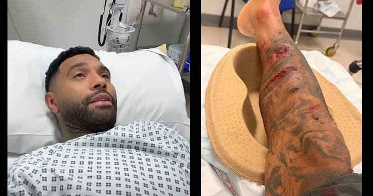 Liverpool un eski yıldızı Jermaine Pennant a köpek saldırdı! Bacağına 50 dikiş atıldı