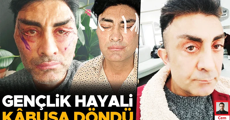 Estetik ameliyatı sonrası kâbusu yaşadı