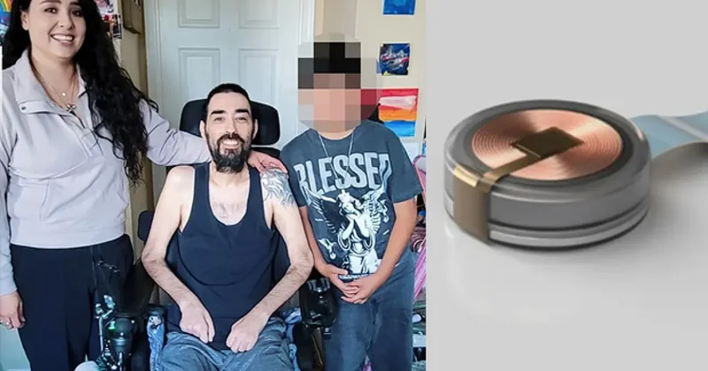 Neuralink te denek krizi: Hasta 4 Nerede? Sorusu gündemdeydi: Aile gerçekleri açıkladı!