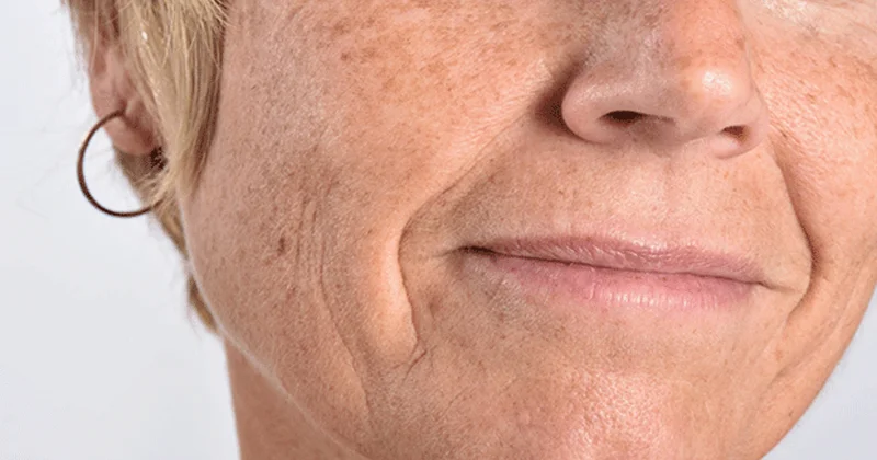 Yaşlanma hızının dönüm noktası ortaya çıktı! Bilim dünyası kritik yaşı açıkladı