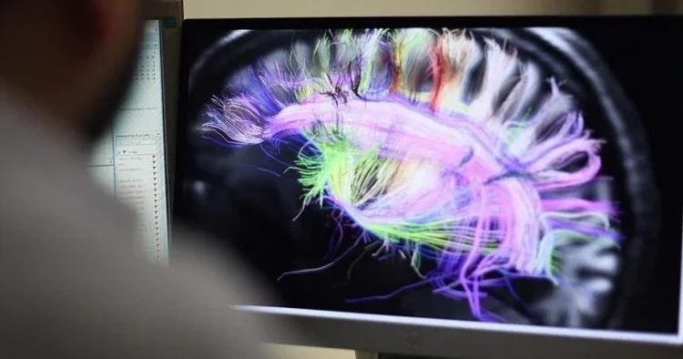 Cambridge Üniversitesinden çarpıcı araştırma: İnsan beyni 5 evreden geçiyor, ergenlik 32 yaşına kadar sürüyor