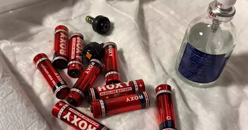 Midesindeki 9 pil, endoskopik yöntemle çıkarıldı