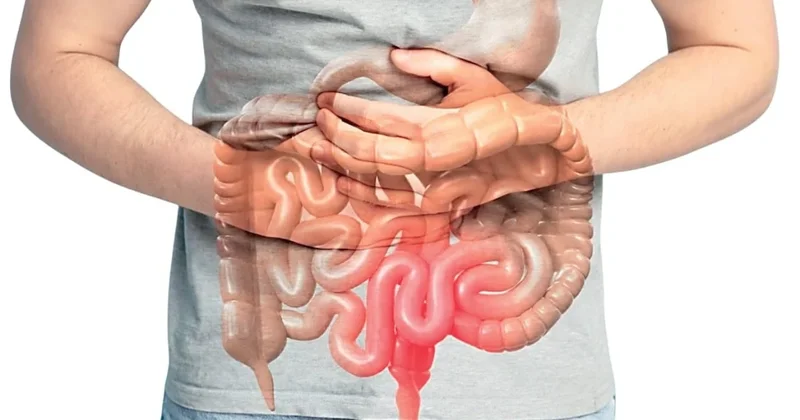 Hastalıkların kökeni bağırsaklarda Sözcü Gazetesi