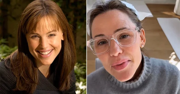 Estetik iddialarını sonunda cevapladı… Üç çocuğu ona yalvarmış: Anne ne olur yüzüne dokunma!