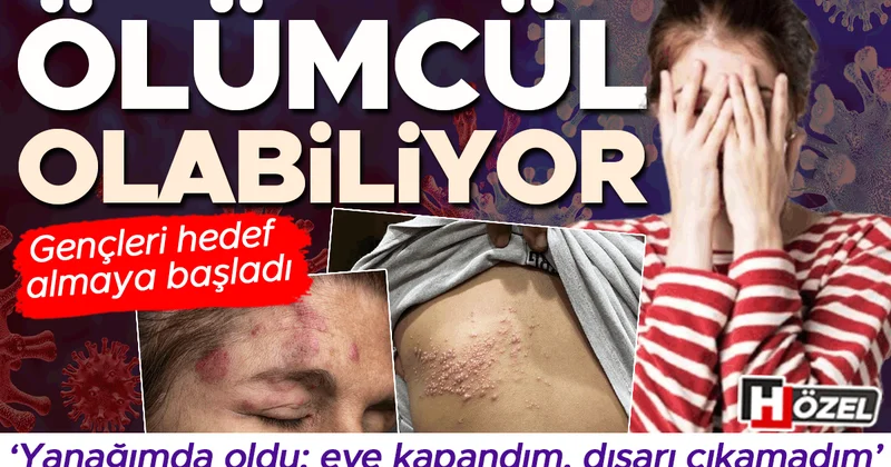 Gençleri hedef alıyor: Ölümcül olabiliyor! ‘Derime kaynar su dökülmüş gibiydi’, ‘Eve kapandım, dışarı çıkamadım’