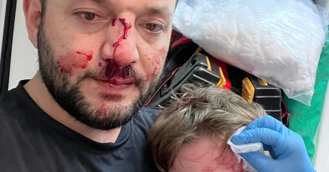 İkra ile babasının darbedilmesine ilişkin iddianame hazırlandı; çocuk skuter ı silah olarak sayıldı Yalova Haberleri