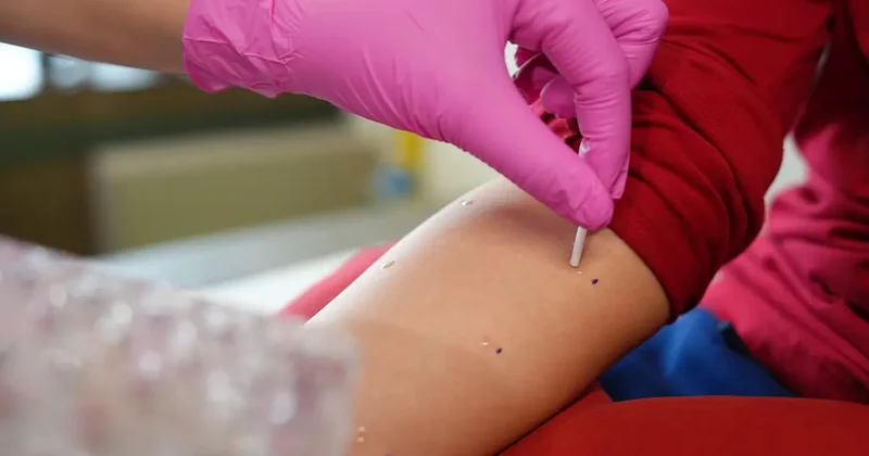 Milyonlarca kişi için kabus başladı! Polen alerjisi alarmı