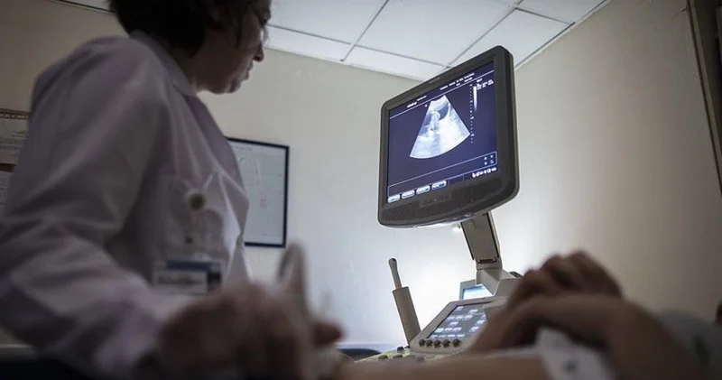 Her 10 kadından biri çikolata kisti ile yaşıyor Sağlık Haberleri