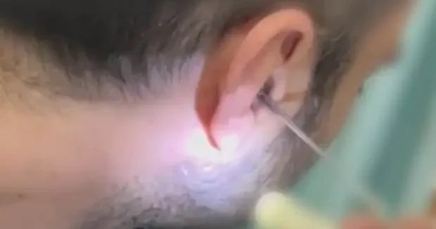 Kayseri haberleri Kayseri de akılalmaz olay: Kulağına gizlediği uyuşturucuyla yakalandı 27 Mart 2026