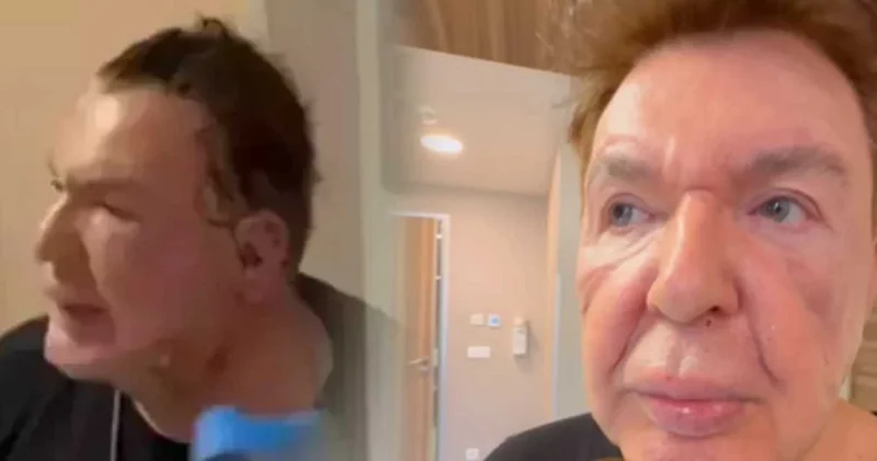 Kuşum Aydın dan yüz gerdirme sonrası yeni paylaşım