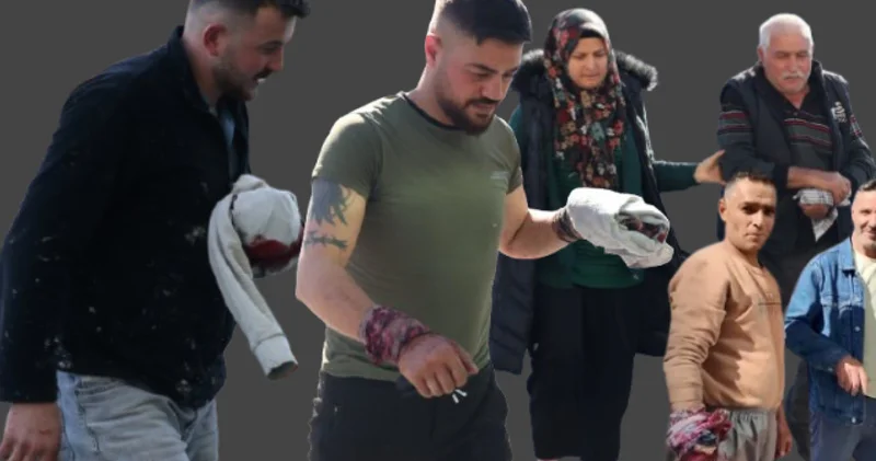 Acemi kasaplar hastanelere koştu! En son haberler Son dakika haberleri