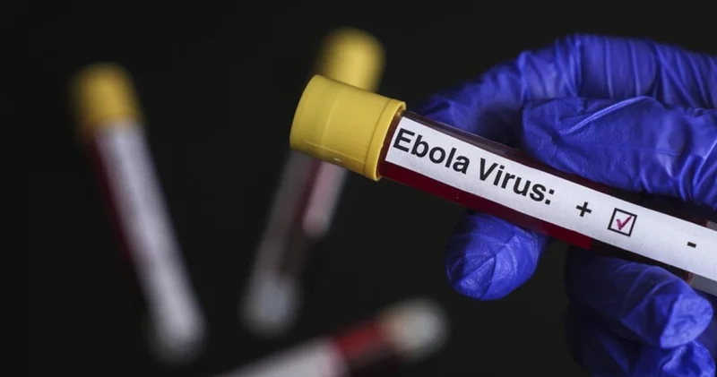 Belçikada Ebolaya karşı önlemler yoğunlaştırılıyor Dış Haberler