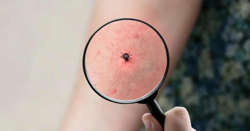 Uzmanından kene uyarısı: Panik yapmayın