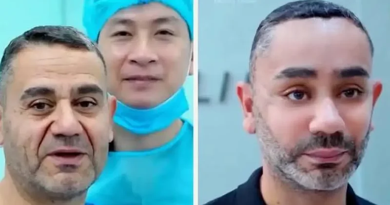 58 yaşında gençleşmek istedi, Vietnam a gitti! Türk uzmandan olay estetik yorumu