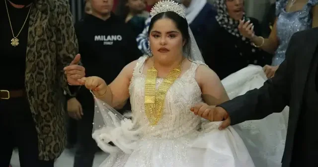 Down sendromlu gencin gelinlik giyme hayali gerçek oldu: Prenses oldum VİDEO İZLE