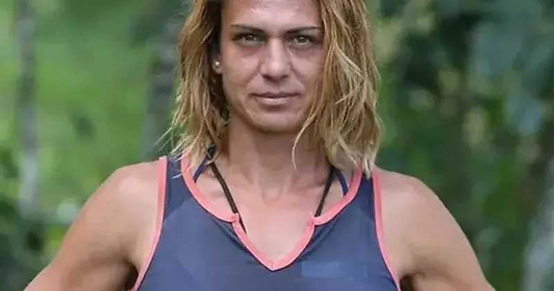 Estetik sonrası paylaşım! Survivor Nagihan Karadere’nin son hali