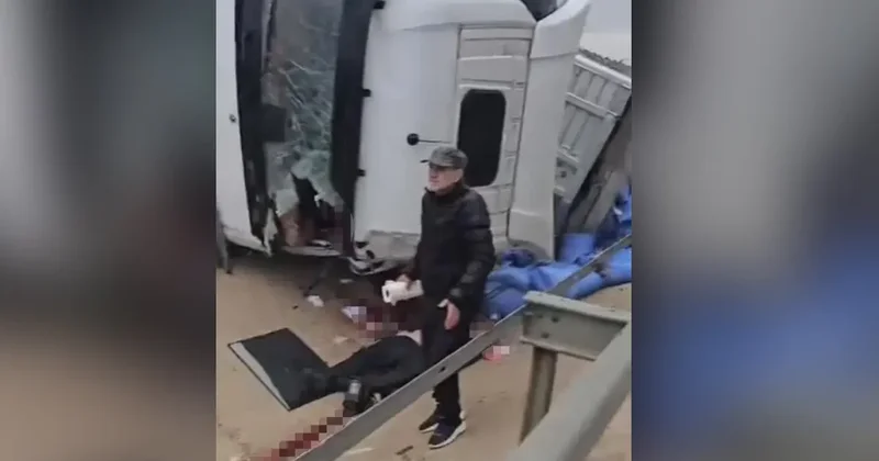 Tır kazasında kolu kopan sürücü tedavi altına alındı