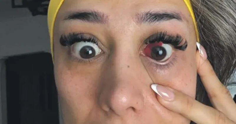 Tavuk yedi, gözü kanlandı