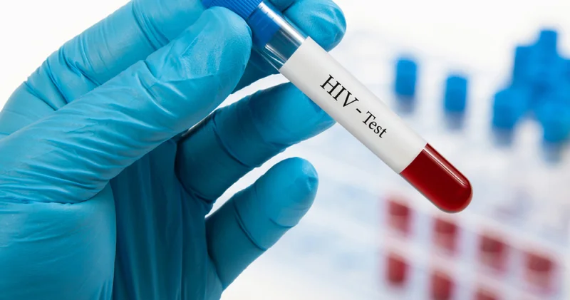 Türkiye de HIV vakaları artıyor Sağlık Haberleri