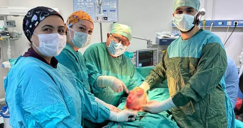 Karnı büyüdü, ‘hamileyim’ sandı: 60 yaşındaki kadından 6 kiloluk kitle çıkarıldı